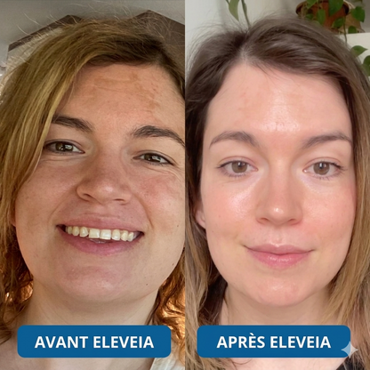 Sérum ultra hydratant à 3% d'acide hyaluronique de Eleveia